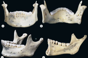 Нижняя челюсть человека фото Нижняя челюсть человека фото