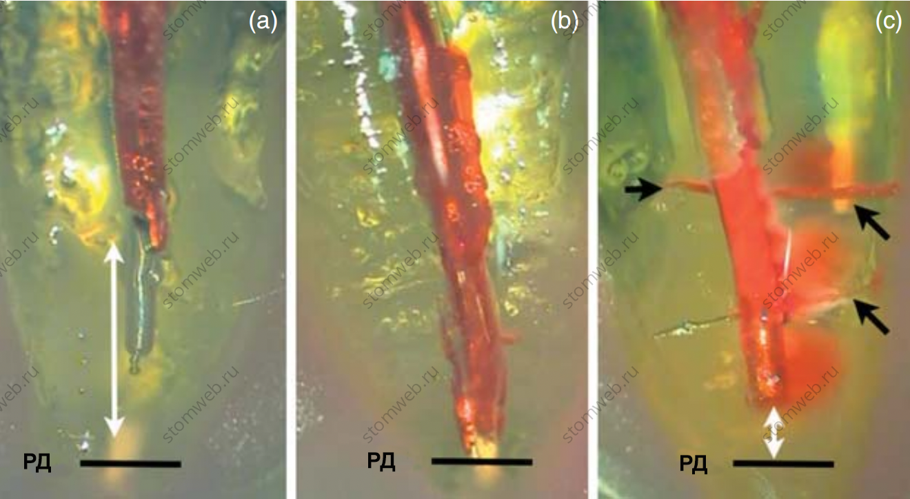 STOMWEB — Ирригация при помощи отрицательного апикального давления